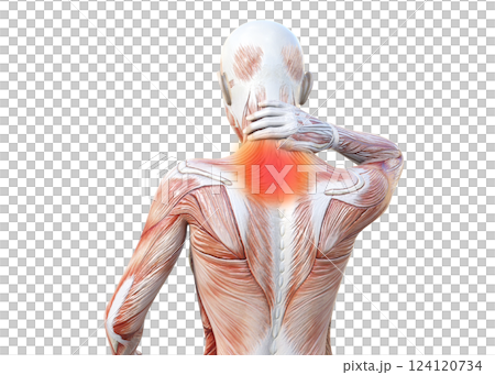 一名女性因頸部僵硬而握住頸部的肌肉解剖圖、上身、後視圖（紅色疼痛圖像）的 3D 插圖 124120734