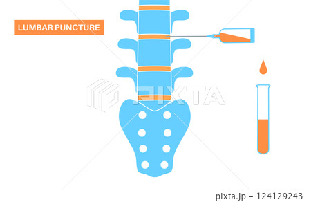 Lumbar puncture spinal tap Lumbar puncture spinal tap 124129243