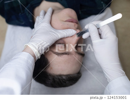 A dermatologist takes a skin scraping and tests for demodicosis and dermatitis, fungal infection. Close-up of a male patient's face at a doctor's appointment A dermatologist takes a skin scraping and tests for demodicosis and dermatitis, fungal infection. Close-up of a male patient's face at a doctor's appointment 124153001