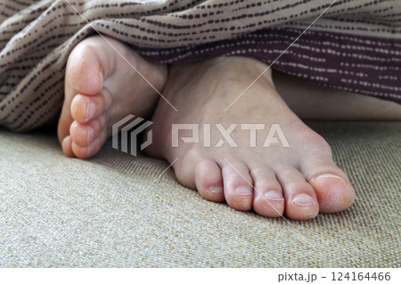 Dry cracked skin of woman feet in bed. Foot treatment. Dry cracked skin of woman feet in bed. Foot treatment. 124164466