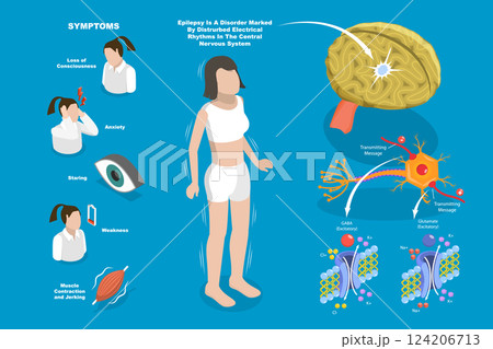 3D Isometric Flat Vector Illustration of Epilepsy, Anatomical Symptoms and Causes 124206713