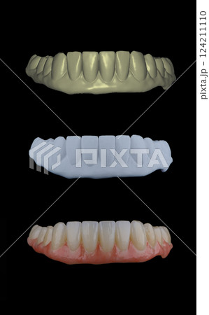 Three stages of making full dental zirkonium prosthesis on titabium bar. Dental care concept. Three stages of making full dental zirkonium prosthesis on titabium bar. Dental care concept. 124211110
