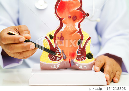 Uterus, doctor holding human anatomy model for study diagnosis and treatment in hospital. Uterus, doctor holding human anatomy model for study diagnosis and treatment in hospital. 124218898