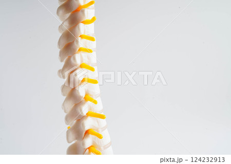 Spinal nerve and bone, Lumbar spine displaced herniated disc fragment, Model for treatment medical in the orthopedic department. Spinal nerve and bone, Lumbar spine displaced herniated disc fragment, Model for treatment medical in the orthopedic department. 124232913