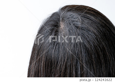 頭頂部の白髪のアホ毛　クローズアップ 124241622