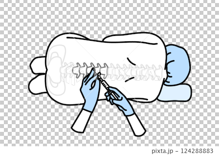 epidural anesthesia epidural anesthesia 124288883