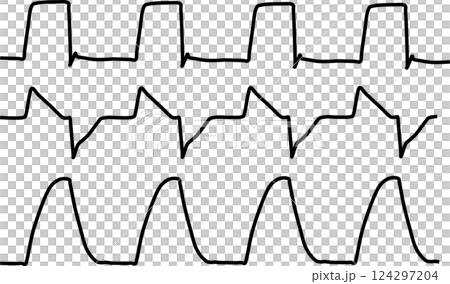 人工呼吸器のグラフィック波形の素材イラスト 124297204