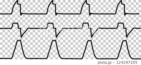 Ventilator graphic waveform material illustration Ventilator graphic waveform material illustration 124297205