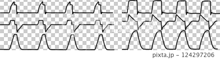人工呼吸器のグラフィック波形の素材イラスト 124297206
