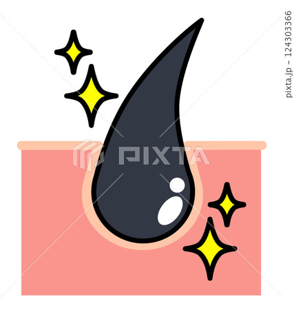 健康な毛根で黒い髪の毛の組織イラスト 健康な毛根で黒い髪の毛の組織イラスト 124303366