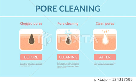 Skin pore cleaning, vector face care, blackhead acne treatment, beauty and dermatology medicine. Clogged face skin cleaning process diagram with before and after pore cleaning treatment steps 124317599