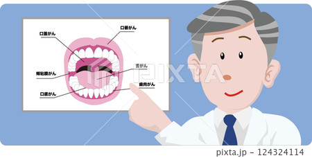口腔がんの説明をする歯科医師 124324114