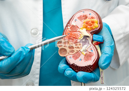 Kidney disease, Chronic kidney disease ckd, Doctor hold human model to treat and study in hospital. Kidney disease, Chronic kidney disease ckd, Doctor hold human model to treat and study in hospital. 124325572