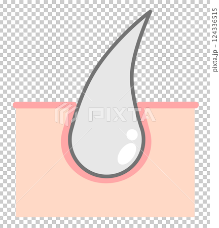 老化現象やストレスで髪の毛が白髪になるイラスト 124336515