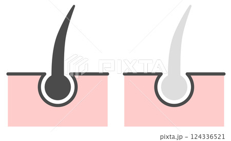 老化現象やストレスで髪の毛が白髪になるイラスト 124336521