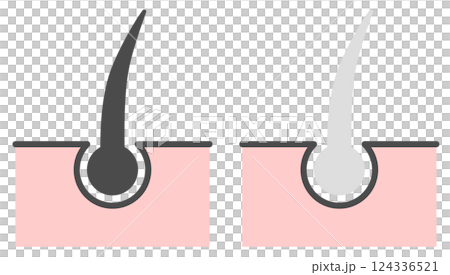 老化現象やストレスで髪の毛が白髪になるイラスト 124336521