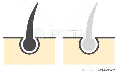 老化現象やストレスで髪の毛が白髪になるイラスト 124336522