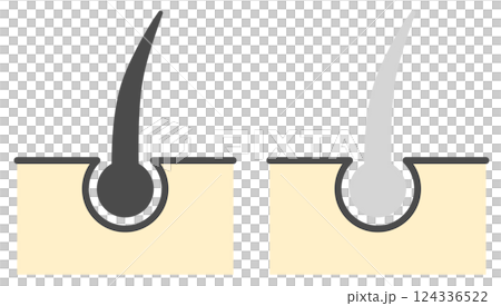 老化現象やストレスで髪の毛が白髪になるイラスト 124336522