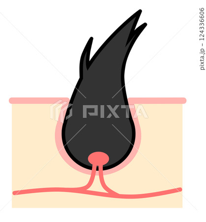 黒髪が乾燥や栄養不足で枝毛になるイラスト 黒髪が乾燥や栄養不足で枝毛になるイラスト 124336606