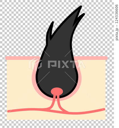 黒髪が乾燥や栄養不足で枝毛になるイラスト 黒髪が乾燥や栄養不足で枝毛になるイラスト 124336606