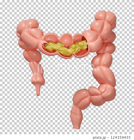3d human colon cross section with waste in the intestine isolated. check colon health, constipation concept, 3d illustration render 124359435