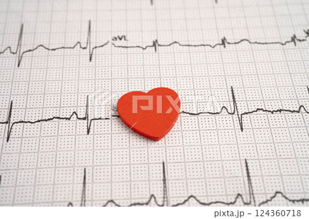 Electrocardiogram ECG heart wave, heart attack, cardiogram report. 124360718