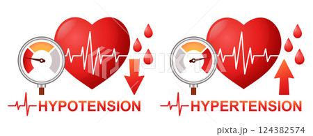 Blood arterial pressure measuring, heart hypertension, cardiac hypotension cardiology cardiovascular disease medical treatment. High, low heartbeat pulse, tonometer. Cardio attack. Health care vector Blood arterial pressure measuring, heart hypertension, cardiac hypotension cardiology cardiovascular disease medical treatment. High, low heartbeat pulse, tonometer. Cardio attack. Health care vector 124382574
