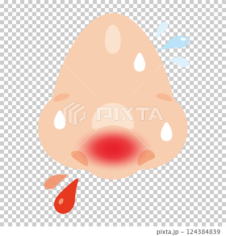 Illustration of a nose with a nosebleed 124384839
