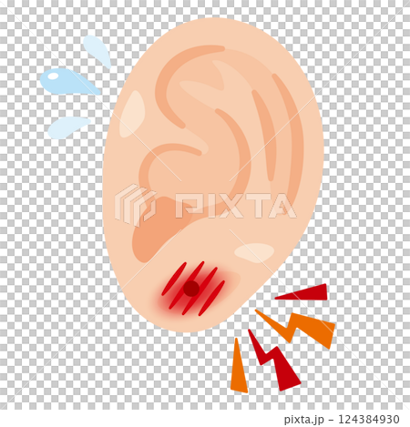 穿孔導致耳朵發炎的圖示 124384930