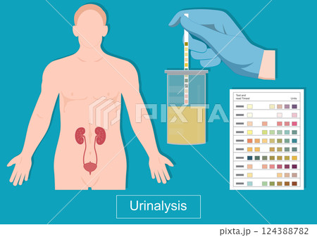 A urinalysis is a laboratory test to detect problems with body 124388782