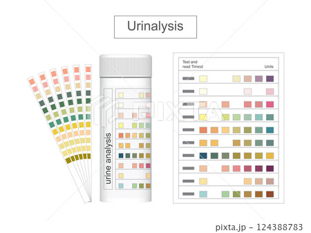 A urinalysis is a simple test that checks urine. 124388783