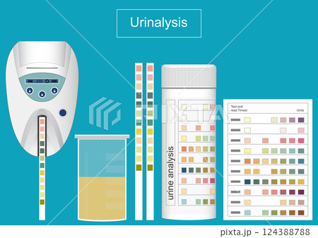 Urine Analysis and urine analyser is a test of urine to check for a urinary tract infection. 124388788