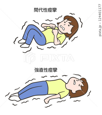 間代性痙攣と強直性痙攣、女性 124401177