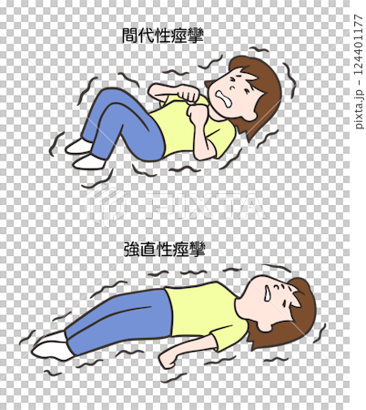 女性陣攣性癲癇與強直性癲癇 女性陣攣性癲癇與強直性癲癇 124401177