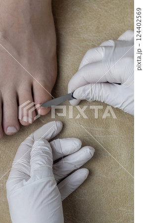 A podiatrist takes a scraping from a nail to examine for a fungal infection. Microbiological examination, taking a swab for the treatment of nail disease 124402569