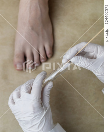 Dermatologist using a cotton swab and test tube to take a swab sample from a patient's leg. Diagnosis of fungal infection, scraping fungal  and microbiological examination 124402573