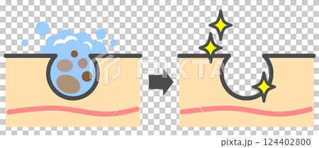 清潔肌膚、清除毛孔中的黑頭、獲得美麗肌膚的插圖 124402800