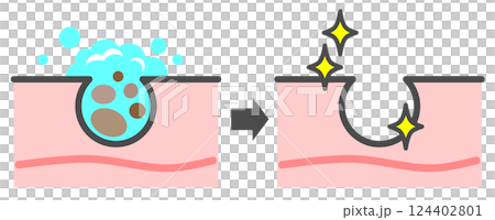 清潔肌膚、清除毛孔中的黑頭、獲得美麗肌膚的插圖 124402801