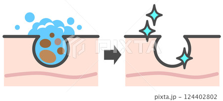 肌を洗浄して毛穴の角栓を洗い流して美肌になるイラスト 肌を洗浄して毛穴の角栓を洗い流して美肌になるイラスト 124402802