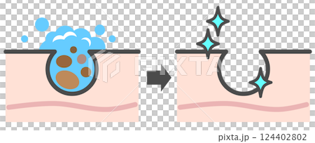 Illustration of cleansing the skin, washing away blackheads from pores, and getting beautiful skin 124402802