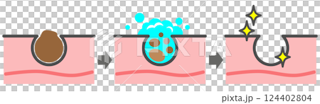 清潔肌膚、清除毛孔中的黑頭、獲得美麗肌膚的插圖 124402804