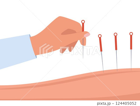 Hand Holding Acupuncture Needle. Chinese needle alternative medicine and treatment symbol collection. Vector illustration. 124405052