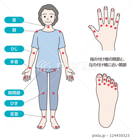 関節リウマチの症状があらわれる主な関節 124430323