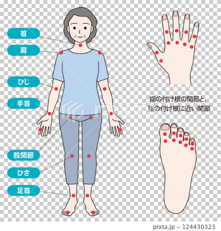 関節リウマチの症状があらわれる主な関節 124430323