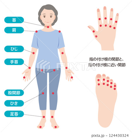 関節リウマチの症状があらわれる主な関節 関節リウマチの症状があらわれる主な関節 124430324