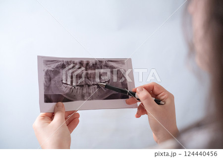 Diagnosis of dental issues with X-ray imaging is a crucial step in treatment and prevention. Diagnosis of dental issues with X-ray imaging is a crucial step in treatment and prevention. 124440456