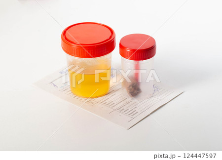 Urine and feces analysis on a medical direction on the table. Concept of tests in urology and gastroenterology, close-up 124447597
