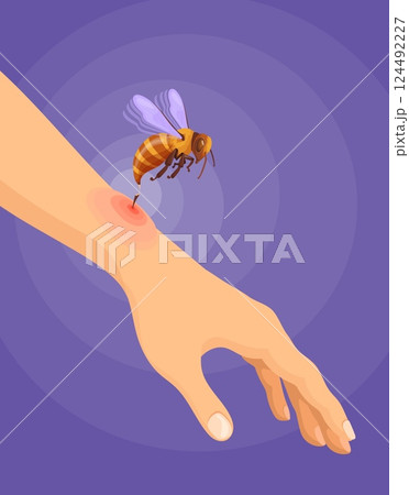 Bee sting. Bees wasp hornet bumblebee bites on skin danger allergy, flying bug insect with dangerous stinger prickle attack emergency medical first aid, neat vector illustration 124492227