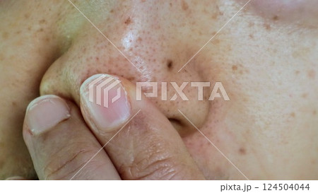 鼻の黒ずみを確認する人物 124504044