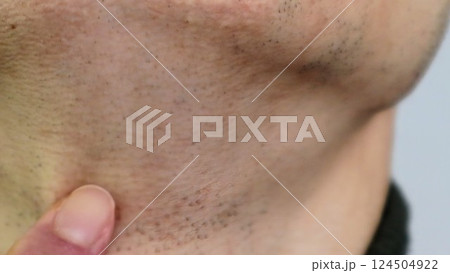 脱毛で薄くなった髭を指差す男性 124504922